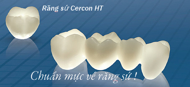 Những điều cần biết về Làm răng sứ Cercon 1