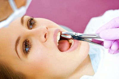 Nhổ răng sâu có nguy hiểm không?