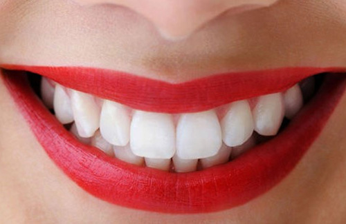 Bọc răng sứ có ảnh hưởng gì không sẽ không còn nếu như thực hiện tại nha khoa uy tín