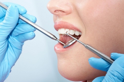 Quy trình kỹ thuật cấy ghép implant răng tại nha khoa Paris Quy trình kỹ thuật cấy ghép implant răng tại nha khoa Paris
