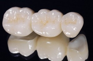 Cách làm đẹp răng bằng phương pháp nào hiệu quả? 1