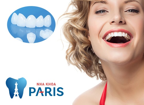 Nha khoa Paris mang lại cho bạn nụ cười tự tin