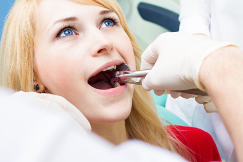 Nhổ răng giá bao nhiêu sẽ tùy thuộc vào độ khó của ca nhổ răng
