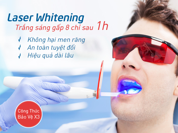 Tẩy trắng răng bằng Laser Whitening là phương pháp tẩy trắng răng vượt trội