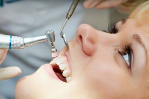 Có nên lấy cao răng thường xuyên, từ 4-6 tháng lấy 1 lần là tốt. Có nên lấy cao răng thường xuyên, từ 4-6 tháng lấy 1 lần là tốt.