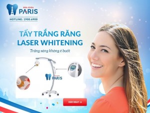 Ưu điểm vượt trội của công nghệ tẩy trắng Laser Whitening tại Nha khoa Paris