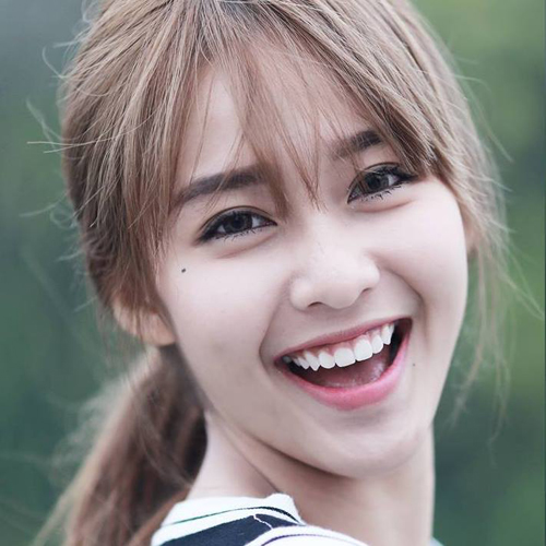 Nguyên nhân và cách khắc phục răng hô TRIỆT ĐỂ nhất