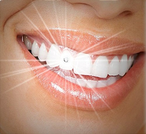 4 yếu tố giúp bạn xác định địa chỉ đính đá vào răng uy tín