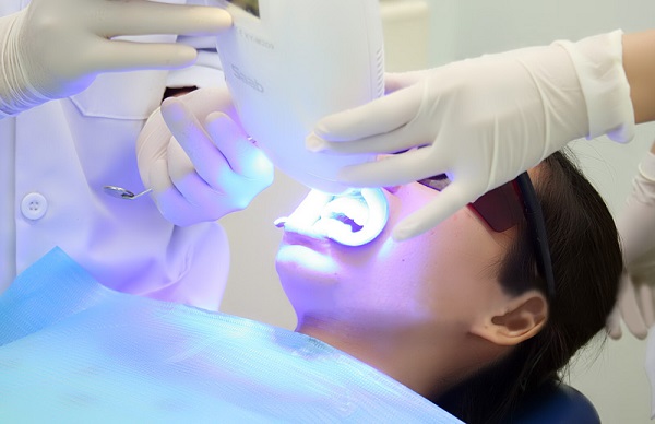 Công nghệ tẩy trắng răng có hiệu quả nhất hiện nay