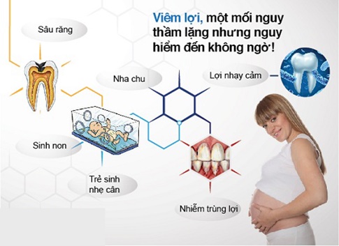 Mẹ bầu bị viêm nha chu tăng khả năng sinh non
