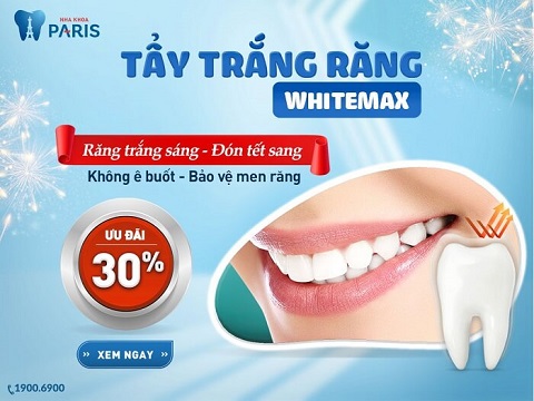 Giá tẩy trắng răng ưu đãi tại nha khoa Paris