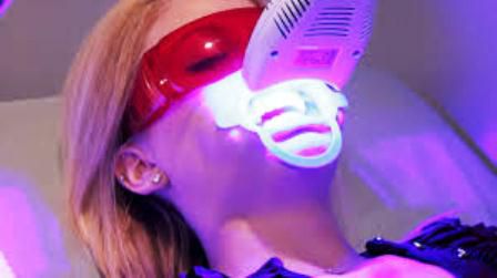 Tẩy trắng răng bằng đèn Plasma có hiệu quả không? Tẩy trắng răng bằng đèn Plasma có hiệu quả không? 1