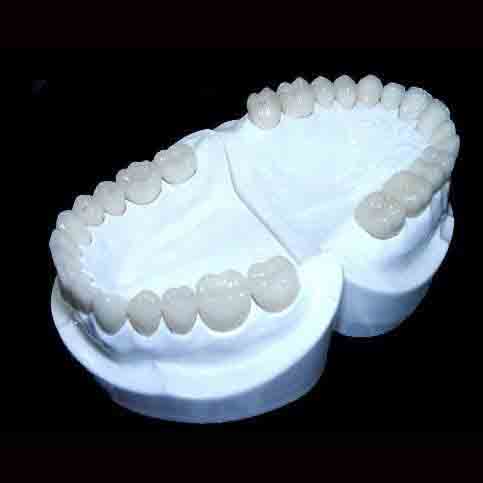 Những nguyên nhân gây răng vẩu chủ yếu