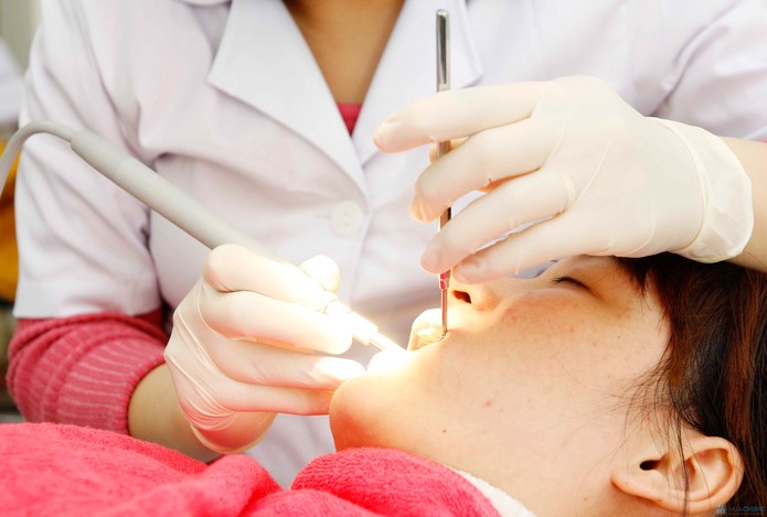 Bao lâu lấy cao răng 1 lần là hợp lý?
