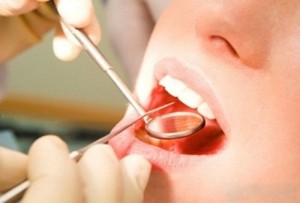 Cách chăm sóc răng sau khi lấy cao răng bạn nên biết