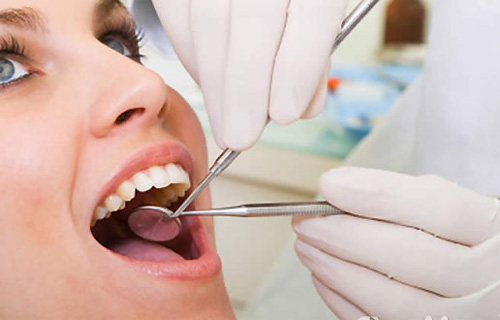Cạo vôi răng giá bao nhiêu tiền là hợp lý?