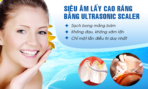 Đang mang thai có nên đi lấy cao răng hay không?