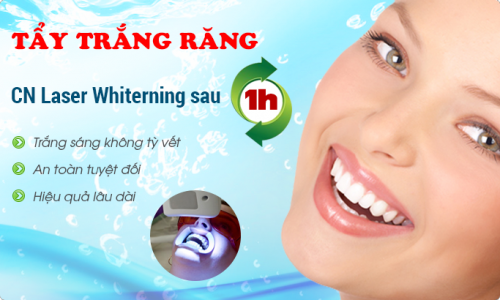 rang-bi-vang-phai-lam-sao-cho-trang-bong-2