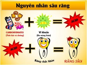 Răng sâu không được điều trị có nguy hiểm hay không?