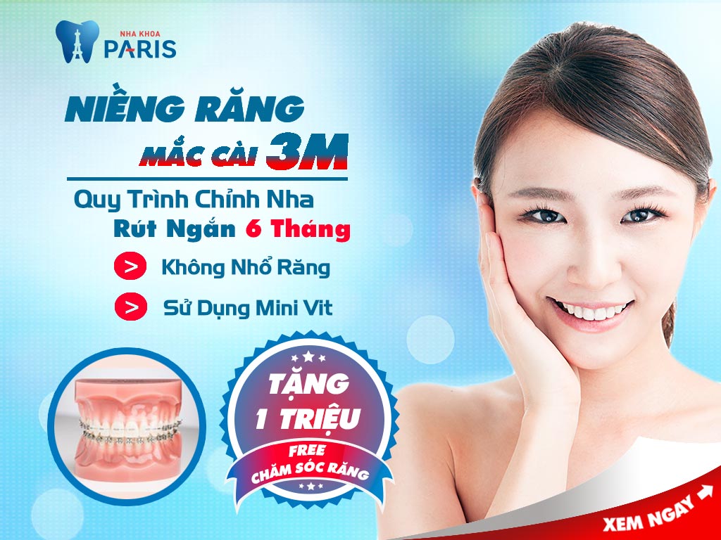 Khi nào cần niềng răng để HIỆU QUẢ TỐT NHẤT? 6