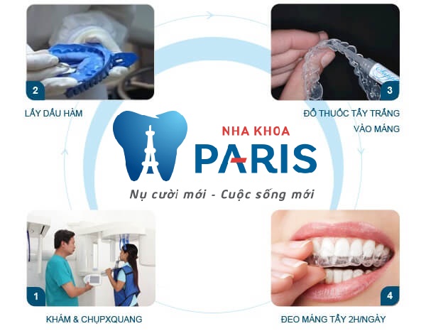 Gợi ý những cách tẩy trắng răng hiệu quả nhất 4