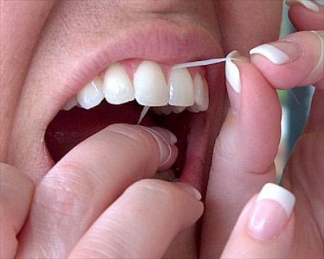 Tẩy trắng răng được bao lâu? Duy trì hiệu quả tại nhà 3