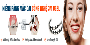 Quy trình niềng răng chuẩn