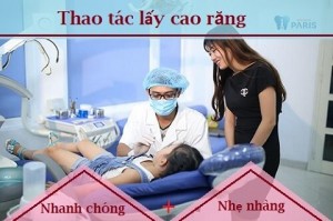 Chia sẻ: Có nên lấy cao răng cho trẻ như người lớn không?