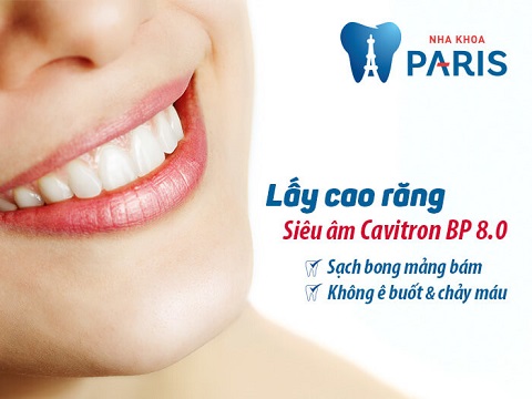 5 cách tự lấy cao răng tại nhà SIÊU ĐƠN GIẢN 6