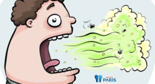 Sâu răng gây hôi miệng nguyên nhân là gì?