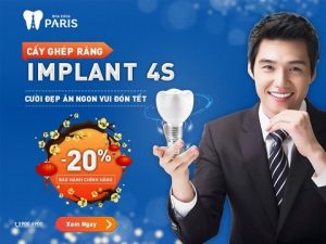 Cấy ghép implant ở đâu UY TÍN mà GIÁ HỢP LÝ NHẤT