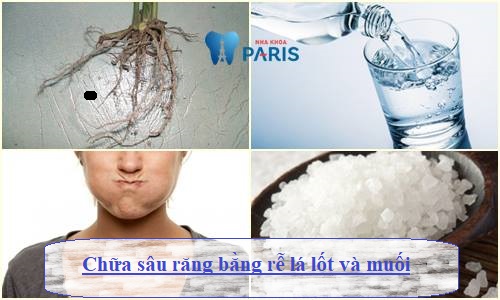 Mẹo chữa sâu răng bằng rễ lá lốt Đơn Giản tại nhà sau 5 phút