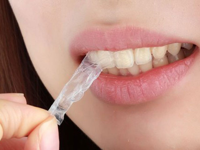 Tẩy trắng răng có hại gì không ? 2