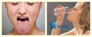 Nguyên nhân khô miệng khát nước về đêm “Cách khắc phục” HIỆU QUẢ