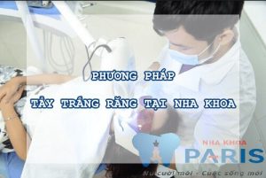 phương pháp tẩy trắng răng 3